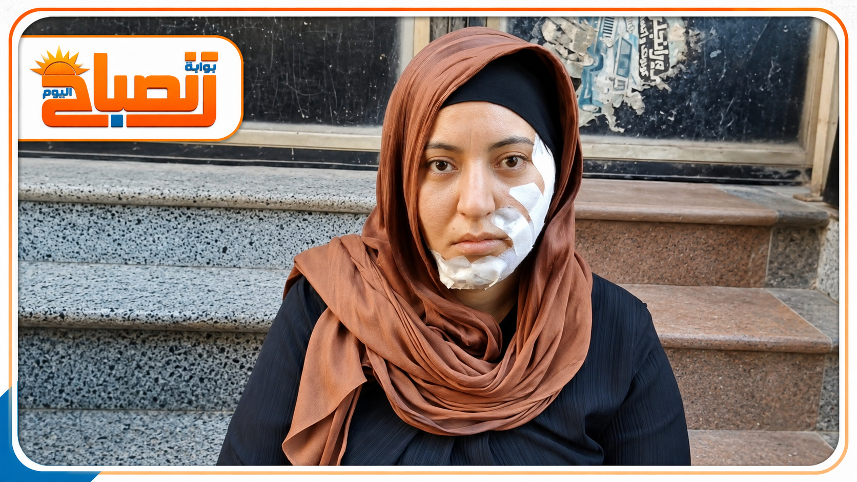 «50 غرزة في وجه سمر».. رفضت ضمه للجمعية فشوّه ملامحها في الشرقية